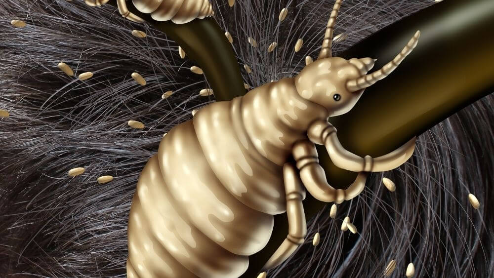 Why do lice live in our hair? - Kidpid