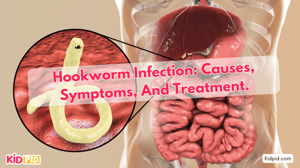 Causes, symptoms, and treatment of hookworm infection.