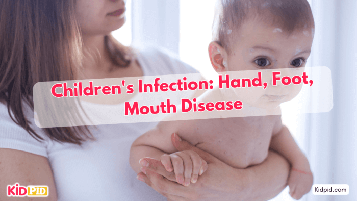 Hand, Foot, and Mouth Disease: Children's Infection
